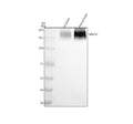 Western blot analysis of NRXN2 using anti-NRXN2 antibody. Electrophoresis was performed on a 8% SDS-PAGE gel at 80V (Stacking gel) / 120V (Resolving gel) for 2 hours. Lane 1: rat brain tissue lysates, Lane 2: mouse brain tissue lysates. After electrophoresis, proteins were transferred to a nitrocellulose membrane at 150 mA for 50-90 min. Blocked the membrane with 5% non-fat milk/TBS for 1.5 hour at RT.