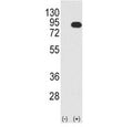 Western blot analysis B-RAF antibody and 293 cell lysate (2 ug/lane) either nontransfected (Lane 1) or transiently transfected with the BRAF gene (2). Predicted size 85-95 kDa