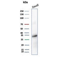 Western blot testing of human Daudi cell lysate with YY1 antibody (YY1/5436). Predicted molecular weight ~45 kDa but commonly observed at 45~65 kDa.