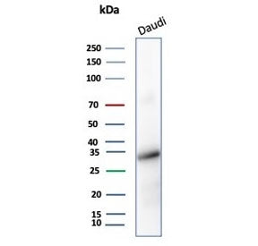 Western blot testing of human Daudi cell lysate with YY1 antibody (YY1/5436). Predicted molecular weight ~45 kDa but commonly observed at 45~65 kDa.
