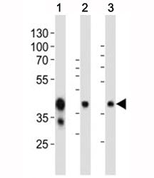 Western blot analysis of mouse tissue lysate using EpCAM antibody at 1:1000. Expected molecular weight: ~35 kDa (unmodified), 40-43 kDa (glycosylated).