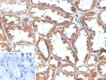 IHC staining of FFPE human kidney tissue with Phospholipase A2 Receptor 1 antibody (clone PLA2R1/4897). Inset: PBS used in place of primary Ab (secondary Ab negative control). HIER: boil tissue sections in pH 9 10mM Tris with 1mM EDTA for 20 min and allow to cool before testing.