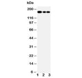 Western blot testing of MRP1 antibody and Lane 1: Jurkat; 2: CEM; 3: A549 lysate. Predicted molecular weight: 152-172 kDa (multiple isoforms), can be observed at ~190 kDa.
