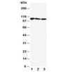Western blot testing of SERCA1 ATPase antibody and Lane 1: rat skeletal muscle; 2: human PANC; 3: (h) U87 cell lysate. Observed size: 99-110KD