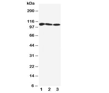 Western blot testing of SERCA1 ATPase antibody and Lane 1: rat skeletal muscle; 2: human PANC; 3: (h) U87 cell lysate. Observed size: 99-110KD