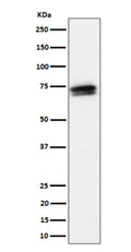 Western blot analysis of SSX2IP expression in HeLa cell lysate using SSX2IP antibody. The expected band size for SSX2IP is at 71 kDa. The protein is observed as multiple species with apparent molecular weights of 70-90 kDa, corresponding to differentially phosphorylated isoforms.