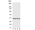 Western blot testing of Carbonic Anhydrase III antibody and Lane 1: SMMC-7721; 2: HeLa; 3: SW620; 4: SCG cell lysate. Predicted/observed molecular weight ~29 kDa.