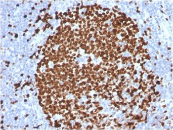 IHC testing of FFPE human tonsil stained with Ki-67 antibody (MKI67/2465). Required HIER: boiling tissue sections in 10mM citrate buffer, pH6, for 10-20 min followed by cooling at RT for 20 min.