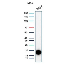 Western blot testing of human 293T cell lysate with recombinant Survivin antibody (clone BIRC5/8936R). Predicted molecular weight ~16 kDa.