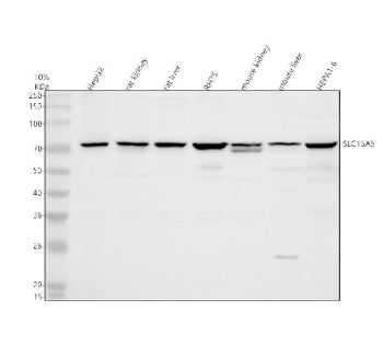 Western blot analysis of SLC15A5 using anti-SLC15A5 antibody. Electrophoresis was performed on a 10% SDS-PAGE gel at 80V (Stacking gel) / 120V (Resolving gel) for 2 hours. Lane 1: human HepG2 whole cell lysates, Lane 2: rat kidney tissue lysates, Lane 3: rat liver tissue lysates, Lane 4: rat RH35 whole cell lysates, Lane 5: rat kidney tissue lysates, Lane 6: mouse liver tissue lysates, Lane 7: mouse HEPA1-6 whole cell lysates.