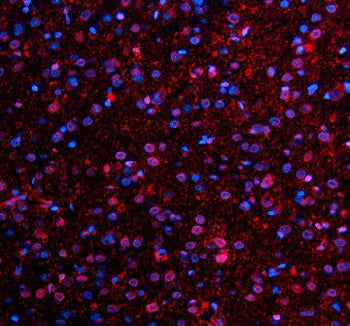 Immunofluorescent staining of NMNAT1 using anti-NMNAT1 antibody (red). NMNAT1 was detected in a paraffin-embedded section of rat brain tissue. Heat mediated antigen retrieval was performed in EDTA buffer (pH 8.0, epitope retrieval solution). The tissue section was blocked with 10% goat serum. The tissue section was then incubated with 5 ug/ml rabbit anti-NMNAT1 antibody overnight at 4oC. Cy3 Conjugated Goat Anti-Rabbit IgG was used as secondary antibody at 1:500 dilution and incubated for 30 min at 37oC.