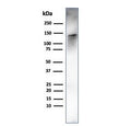Western blot testing of human ovary tissue lysate using recombinant Caldesmon antibody (clone rCALD1/820). Predicted molecular weight ~93 kDa, can be observed at 70-80 kDa (non muscle tissue) and 120-150 kDa (smooth muscle).