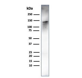 Western blot testing of human ovary tissue lysate using recombinant Caldesmon antibody (clone rCALD1/820). Predicted molecular weight ~93 kDa, can be observed at 70-80 kDa (non muscle tissue) and 120-150 kDa (smooth muscle).