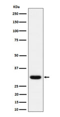 Western blot analysis of Adiponectin expression in human plasma lysate using ADIPOQ antibody.