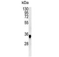 Western blot testing of mouse spleen tissue lysate with CYRIA antibody. Predicted molecular weight ~37 kDa.