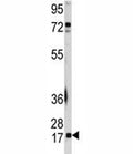 Western blot analysis of UBE2I antibody and A2058 lysate.