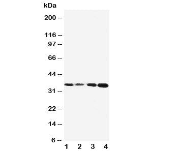 Western blot testing of Protein C antibody and Lane 1: Jurkat; 2: CEM; 3: SMMC-7721; 4: HeLa cell lysate. Observed size: 35KD, predicted size: 52KD