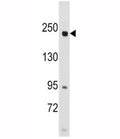Western blot analysis of RICTOR antibody and SK-BR-3 lysate.