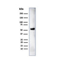 Western blot testing of human MCF-7 cell lysate using IRF3 antibody (clone PCRP-IRF3-1E11). Predicted molecular weight ~47 kDa.