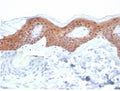 IHC staining of FFPE human skin tissue with SERPINB5 antibody (clone SERPINB5/4979). Negative control inset: PBS instead of primary antibody to control for secondary binding. HIER: boil tissue sections in pH 9 10mM Tris with 1mM EDTA for 20 min and allow to cool before testing.