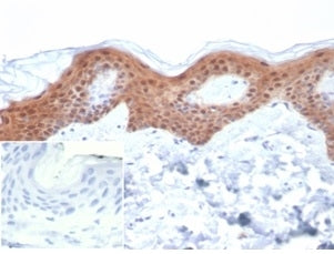 IHC staining of FFPE human skin tissue with SERPINB5 antibody (clone SERPINB5/4979). Negative control inset: PBS instead of primary antibody to control for secondary binding. HIER: boil tissue sections in pH 9 10mM Tris with 1mM EDTA for 20 min and allow to cool before testing.