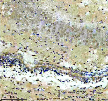 Immunohistochemical staining of CXXC5 using anti-CXXC5 antibody. CXXC5 was detected in a paraffin-embedded section of mouse brain tissue. Heat mediated antigen retrieval was performed in EDTA buffer (pH 8.0, epitope retrieval solution). The tissue section was blocked with 10% goat serum. The tissue section was then incubated with 2 ug/ml rabbit anti-CXXC5 antibody overnight at 4oC. Peroxidase Conjugated Goat Anti-rabbit IgG was used as secondary antibody and incubated for 30 min at 37oC.