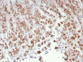 IHC staining of FFPE human adrenal gland tissue with Interleukin-15 antibody (clone IL15/4699). HIER: boil tissue sections in pH 9 10mM Tris with 1mM EDTA for 20 min and allow to cool before testing.