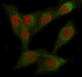 Immunofluorescent staining of FOXC2 using anti-FOXC2 antibody (red) and anti-Tubulin Alpha antibody (green). FOXC2 was detected in immunocytochemical section of Hela cell. Enzyme antigen retrieval was performed using IHC enzyme antigen retrieval reagent for 15 mins. The cells were blocked with 10% goat serum. And then incubated with 5 ug/ml rabbit anti-FOXC2 antibody and mouse anti-Tubulin Alpha antibody overnight at 4oC.