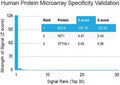 Protein array validation of the Bcl6 antibody: Analysis of HuProt(TM) microarray containing more than 19,000 full-length human proteins using Bcl6 antibody (clone BCL6/1527). These results demonstrate the foremost specificity of the BCL6/1527 mAb. Z- and S- score: The Z-score represents the strength of a signal that an antibody (in combination with a fluorescently-tagged anti-IgG secondary Ab) produces when binding to a particular protein on the HuProt(TM) array.