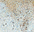 Immunohistochemical staining of TPH2 using anti-TPH2 antibody. TPH2 was detected in a paraffin-embedded section of mouse brain tissue. Heat mediated antigen retrieval was performed in EDTA buffer (pH 8.0, epitope retrieval solution). The tissue section was blocked with 10% goat serum. The tissue section was then incubated with 1:50 rabbit anti-TPH2 antibody overnight at 4oC. Peroxidase Conjugated Goat Anti-rabbit IgG was used as secondary antibody and incubated for 30 min at 37oC.