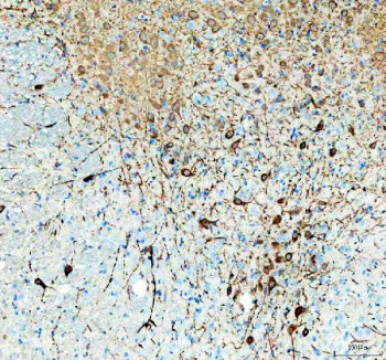 Immunohistochemical staining of TPH2 using anti-TPH2 antibody. TPH2 was detected in a paraffin-embedded section of mouse brain tissue. Heat mediated antigen retrieval was performed in EDTA buffer (pH 8.0, epitope retrieval solution). The tissue section was blocked with 10% goat serum. The tissue section was then incubated with 1:50 rabbit anti-TPH2 antibody overnight at 4oC. Peroxidase Conjugated Goat Anti-rabbit IgG was used as secondary antibody and incubated for 30 min at 37oC.