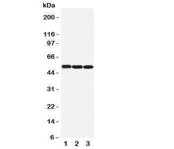 Western blot testing of beta Arrestin 1 antibody and Lane 1: rat lung; 2: rat skeletal muscle; 3: human SW620 cell lysate. Predicted molecular weight ~51 kDa.