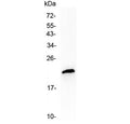 Western blot testing of human MCF7 cell lysate with TMEM107 antibody at 0.5ug/ml. Predicted molecular weight ~16 kDa, routinely observed at ~19 kDa.