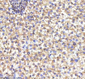 IHC staining of FFPE zebrafish liver tissue with Myd88 antibody, HRP-labeled secondary and DAB substrate. HIER: boil tissue sections in pH8 EDTA for 20 min and allow to cool before testing.