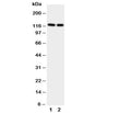 Western blot testing of NRP2 antibody and Lane 1: rat brain; 2: rat testis. Predicted size: 116-130KD
