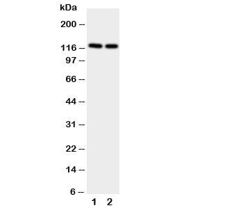 Western blot testing of NRP2 antibody and Lane 1: rat brain; 2: rat testis. Predicted size: 116-130KD