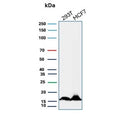 Western blot testing of human 293T and MCF-7 cell lysate with NME2 antibody (clone NME2/4160). Predicted molecular weight ~17 kDa.