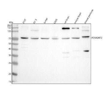 Western blot analysis of POMGNT2 using anti-POMGNT2 antibody. Lane 1: human 293T whole cell lysates, Lane 2: human PC-3 whole cell lysates, Lane 3: human Jurkat whole cell lysates, Lane 4: human U2OS whole cell lysates, Lane 5: rat brain tissue lysates, Lane 6: mouse brain tissue lysates, Lane 7: mouse pancreas tissue lysates. After electrophoresis, proteins were transferred to a nitrocellulose membrane at 150 mA for 50-90 min. Blocked the membrane with 5% non-fat milk/TBS for 1.5 hour at RT.