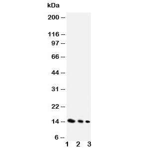 Western blot testing of IL-4 antibody and Lane 1: recombinant mouse protein 10ng; 2: 5ng; 3: 2.5ng. Expected molecular weight: 14-20 kDa depending on glycosylation level.