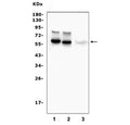 Western blot testing of 1) rat brain, 2) mouse brain and 3) human U-87 MG cell lysate with Tyrosine Hydroxylase antibody. Predicted molecular weight ~59 kDa.