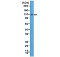 Western blot testing of mouse spleen tissue lysate using recombinant CD34 antibody at 1:100 dilution. Observed molecular weight: 41~110 kDa depending on level of glycosylation.