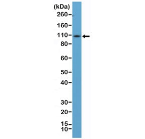 Western blot testing of mouse spleen tissue lysate using recombinant CD34 antibody at 1:100 dilution. Observed molecular weight: 41~110 kDa depending on level of glycosylation.