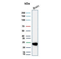 Western blot testing of human brain tissue lysate with PGP9.5 antibody. Predicted molecular weight ~25 kDa.