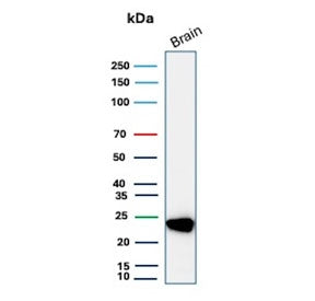 Western blot testing of human brain tissue lysate with PGP9.5 antibody. Predicted molecular weight ~25 kDa.