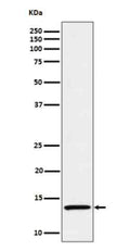 Western blot analysis of IL15 in Recombinant human IL-15 protein cell lysate.