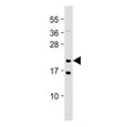 Western blot testing of NRAS antibody at 1:2000 + rat PC12 cell lysate. Predicted molecular weight ~21 kDa.