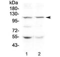 Western blot testing of human 1) HeLa and 2) SW620 lysate with DPYD antibody at 0.5ug/ml. Predicted molecular weight ~111 kDa.