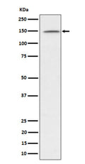 Western blot analysis of phospho-Phospholipase C gamma 1/PLC-gamma-1 (Y1253) expression in Jurkat treated with Pervanadate lysate, using Phospho-Phospholipase C gamma 1 (Tyr1253) antibody.