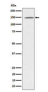 Western blot analysis of phospho-Phospholipase C gamma 1/PLC-gamma-1 (Y1253) expression in Jurkat treated with Pervanadate lysate, using Phospho-Phospholipase C gamma 1 (Tyr1253) antibody.