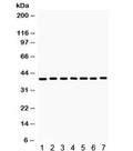 Western blot testing of rat 1) skeletal muscle, 2) kidney, 3) heart, 4) NRK, and human 5) 293, 6) HeLa and 7) MCF7 lysate with HDAC11 antibody. Expected/observed molecular weight ~39 kDa.